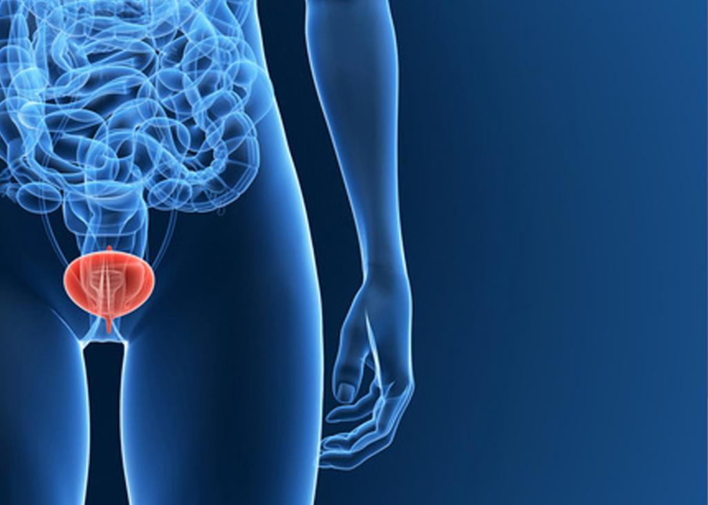 Cystitis dan Dampaknya terhadap Kenyamanan Tubuh Sehari-hari